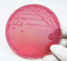 escherichia coli într-o frotiu