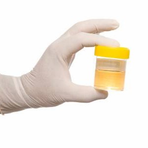 Bacteriile patogene în urină, ce înseamnă aceasta?